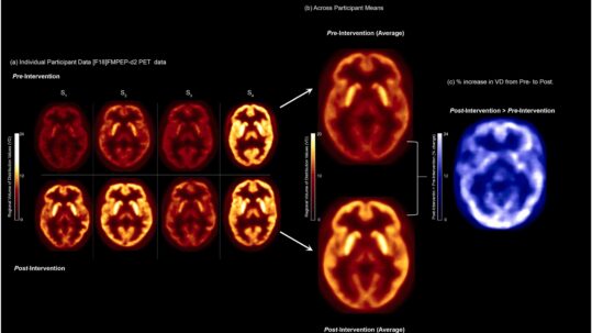 Štúdia uverejnená v science direct priniesla dôkazy o tom, že metóda dokáže pozitívne ovplyvniť mozgové procesy spojené so zvládaním stresu, náladou a úzkosťou. Vedci z Wayne State University skúmali, ako Wim Hof metóda pôsobí na mozgové oblasti súvisiace s interocepciou (vnútorného vnímania tela) a reguláciou emócií. Výsledky ukazujú, že kombinácia kontrolovaných stresorov (WHM techník) má významný vplyv na psychickú pohodu a odolnosť voči stresu.